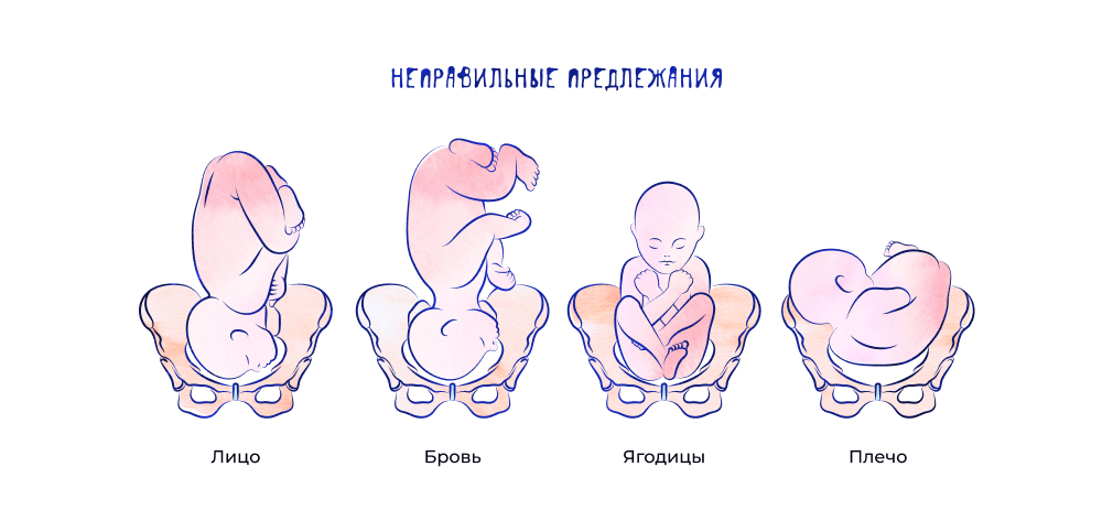 Неправильные предлежания.png
